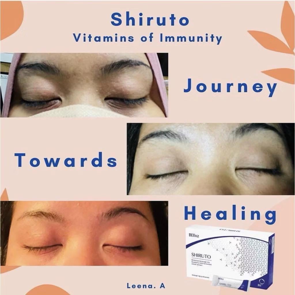 Shiruto Immune Supplement – 1 Box • 30 Sachets each Box • Free Shipping